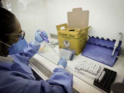 DF registra 29 casos importados de malária sem transmissão local